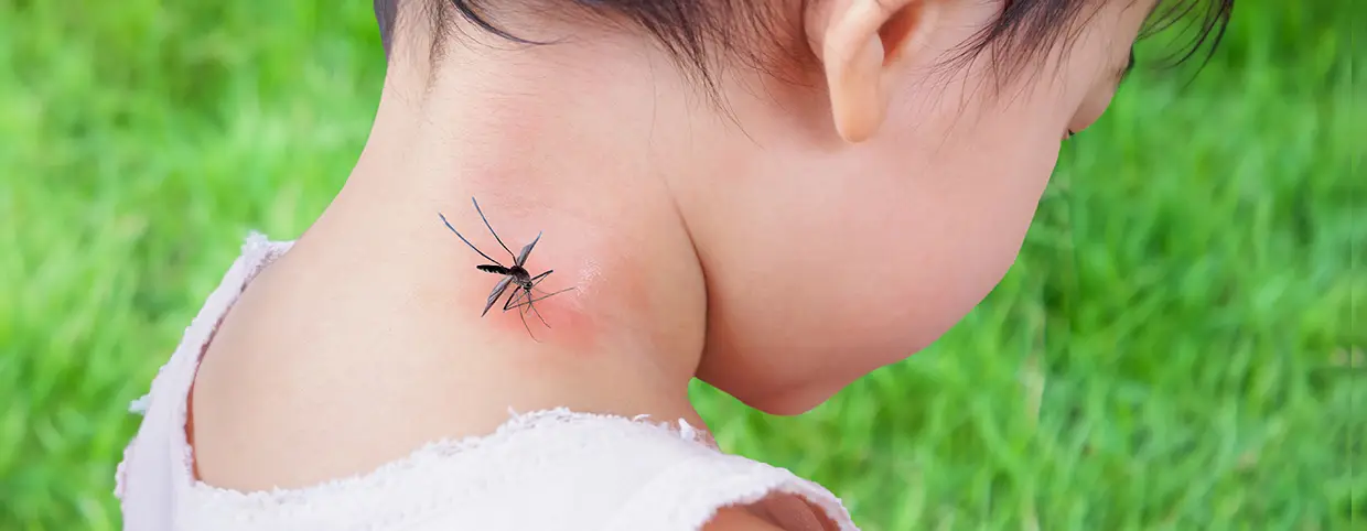 Mosquito on kid’s neck